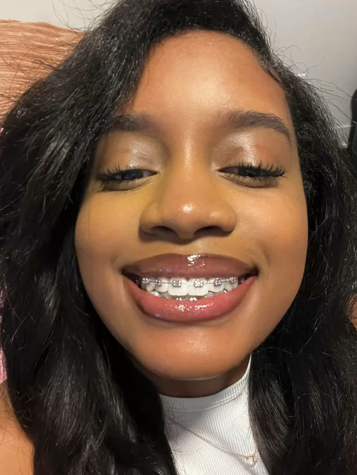Fixed Orthodontics (Braces) at Lebanon Dental Care Clinic in Mombasa, Kenya