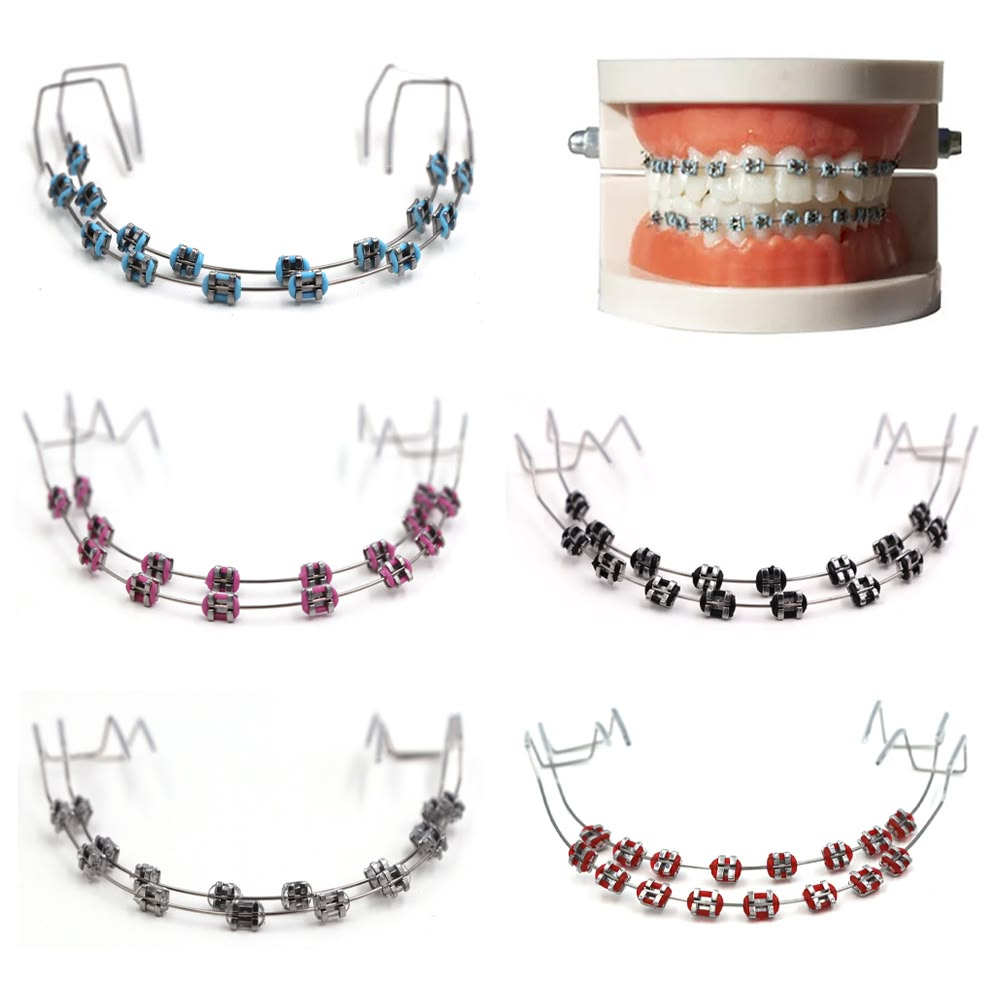 Removable Orthodontic Appliances at Lebanon Dental Care Clinic in Mombasa, Kenya